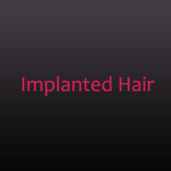 Implanted Hair